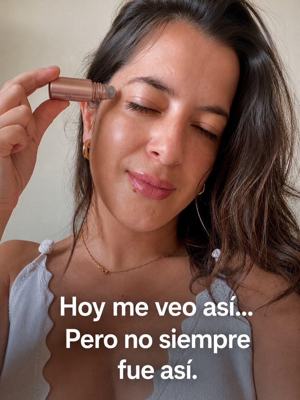 Hoy me veo así.
Pero no siempre fue así.
También tuve acné hormonal.También pasé por momentos difíciles.También hubo meses en los que dejé de cuidarme.
Mi piel reflejaba exactamente cómo me sentía.
Con el tiempo entendí que no necesitaba soluciones agresivas. Necesitaba paciencia, constancia y productos que respetaran mi piel.
Por eso elegí el skincare natural.
Porque después de cada tormenta, mi piel siempre agradece que la cuide con ingredientes puros y sin químicos agresivos.
Esta no es solo una historia de skincare.Es una historia de volver a elegirme todos los días.
¿Te identificas mi historia? Te leo en los comentarios.